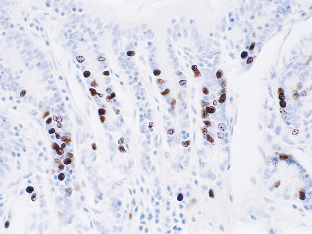 BrdU Antibody in Immunohistochemistry (IHC)