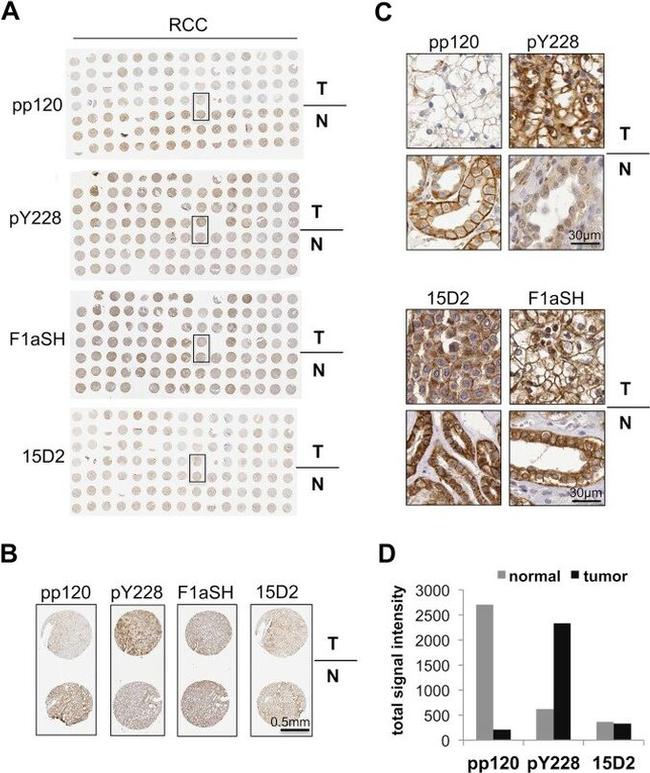 delta Catenin Antibody in Immunohistochemistry (IHC)