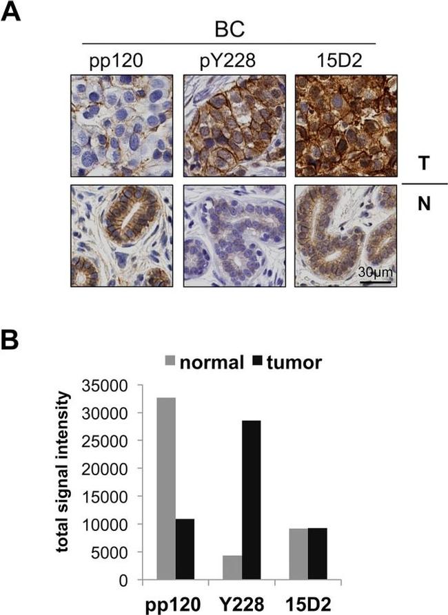 delta Catenin Antibody in Immunohistochemistry (IHC)