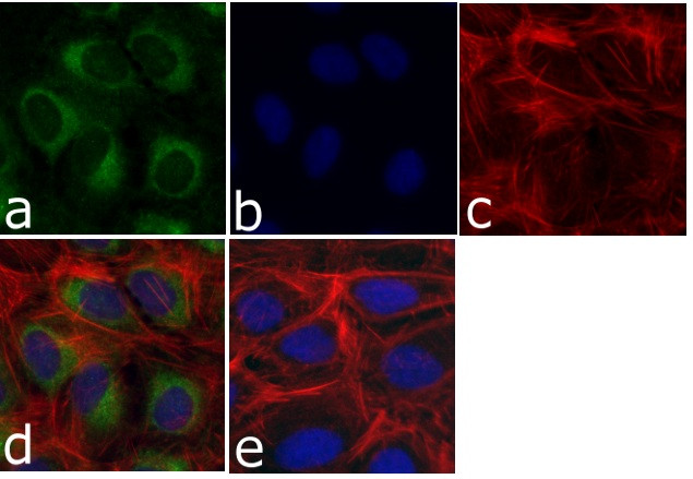 delta Catenin Antibody in Immunocytochemistry (ICC/IF)