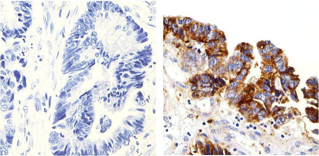 delta Catenin Antibody in Immunohistochemistry (Paraffin) (IHC (P))