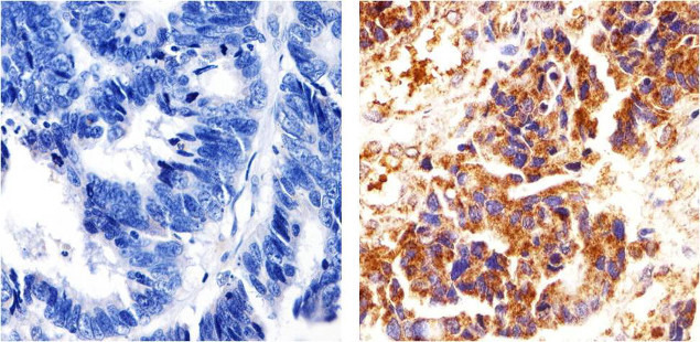 delta Catenin Antibody in Immunohistochemistry (Paraffin) (IHC (P))