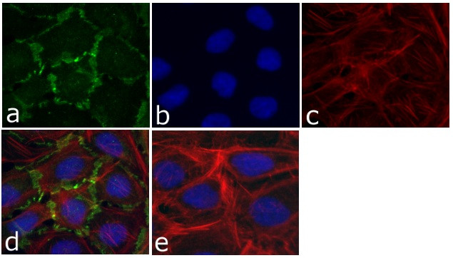 delta Catenin Antibody in Immunocytochemistry (ICC/IF)