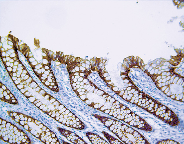 Claudin 3 Antibody in Immunohistochemistry (IHC)