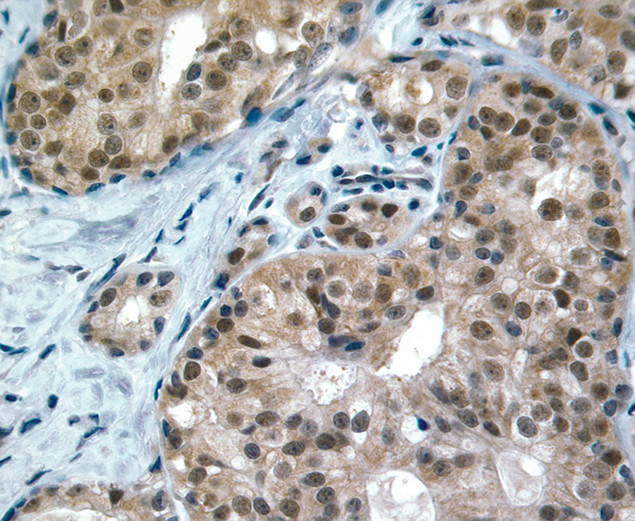 c-Kit Antibody in Immunohistochemistry (IHC)