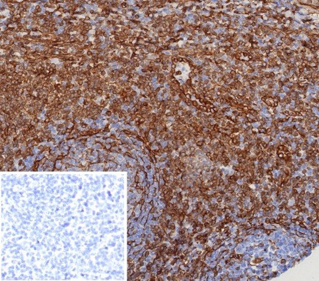 STING1/TMEM173 Antibody in Immunohistochemistry (Paraffin) (IHC (P))