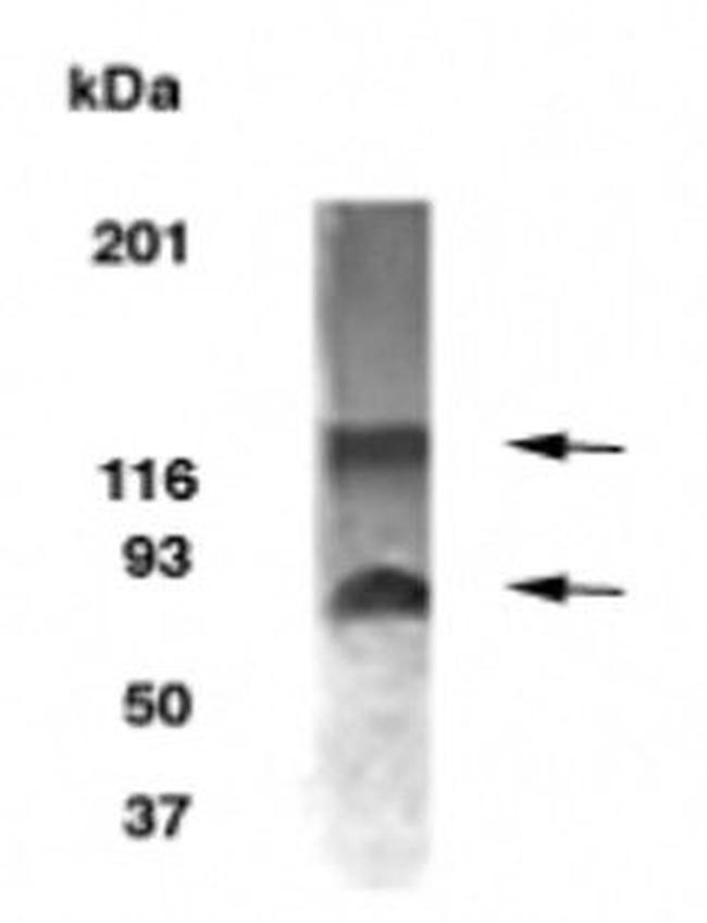 BCAS1/NABC1 Antibody in Western Blot (WB)