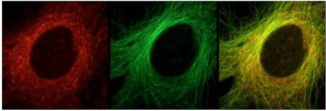 ch-TOG Antibody in Immunocytochemistry (ICC/IF)