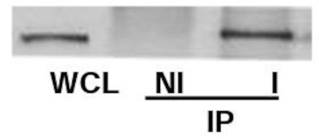 ch-TOG Antibody in Immunoprecipitation (IP)