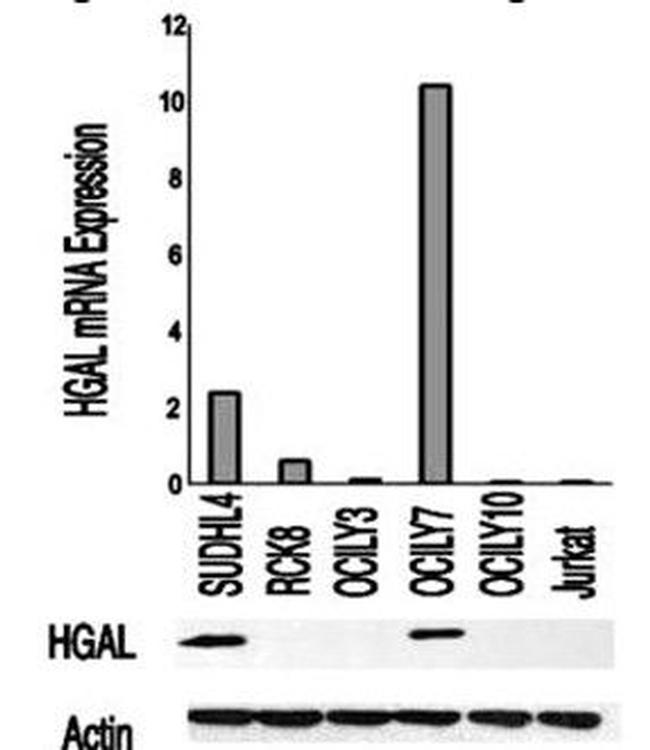 HGAL Antibody in Western Blot (WB)