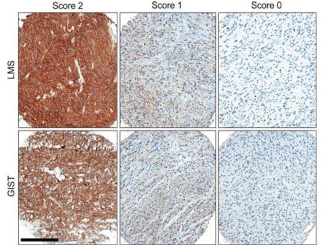 ROR2 Antibody in Immunohistochemistry (Paraffin) (IHC (P))