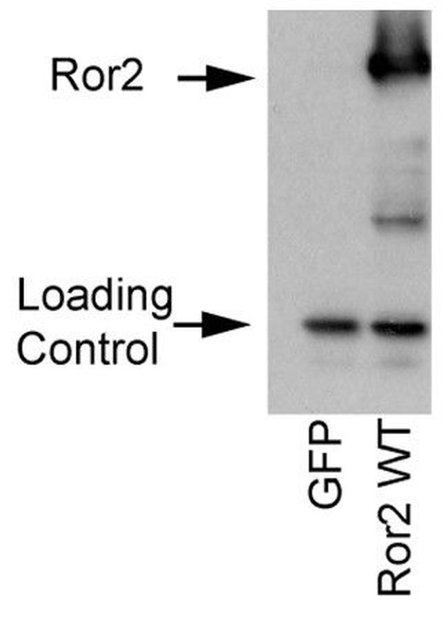 ROR2 Antibody in Western Blot (WB)