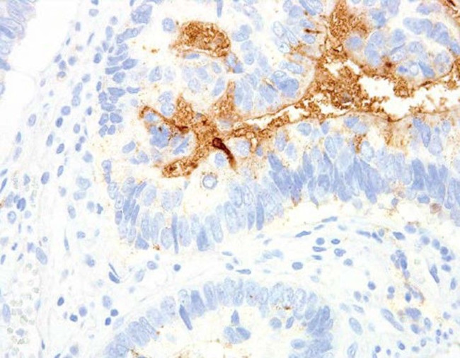 TAG-72 Antibody in Immunohistochemistry (Paraffin) (IHC (P))