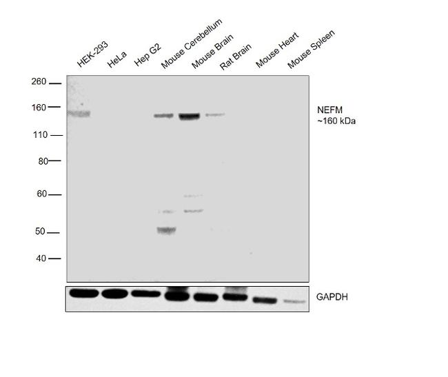 NEFM Antibody in Western Blot (WB)