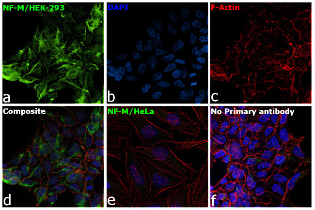 NEFM Antibody in Immunocytochemistry (ICC/IF)