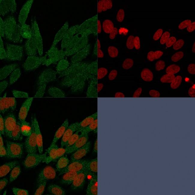 IDH1 (Isocitrate Dehydrogenase) Antibody in Immunocytochemistry (ICC/IF)