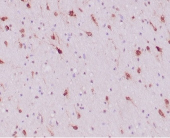 IDH1-R132H (Isocitrate Dehydrogenase) Antibody in Immunohistochemistry (Paraffin) (IHC (P))