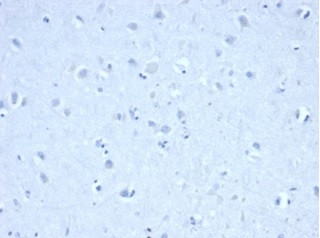 IDH1-R132H (Isocitrate Dehydrogenase) Antibody in Immunohistochemistry (Paraffin) (IHC (P))