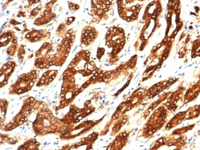 IDH1-R132H (Isocitrate Dehydrogenase) Antibody in Immunohistochemistry (Paraffin) (IHC (P))