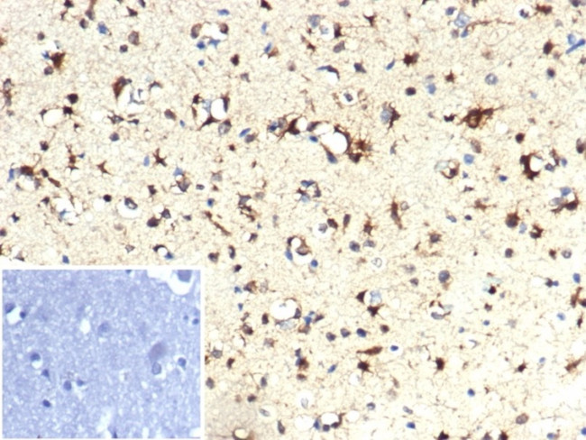 IDH1-R132H (Isocitrate Dehydrogenase) Antibody in Immunohistochemistry (Paraffin) (IHC (P))