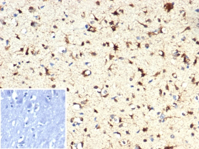 IDH1-R132H (Isocitrate Dehydrogenase) Antibody in Immunohistochemistry (Paraffin) (IHC (P))