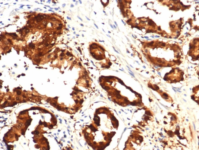 IDH1-R132H (Isocitrate Dehydrogenase) Antibody in Immunohistochemistry (Paraffin) (IHC (P))