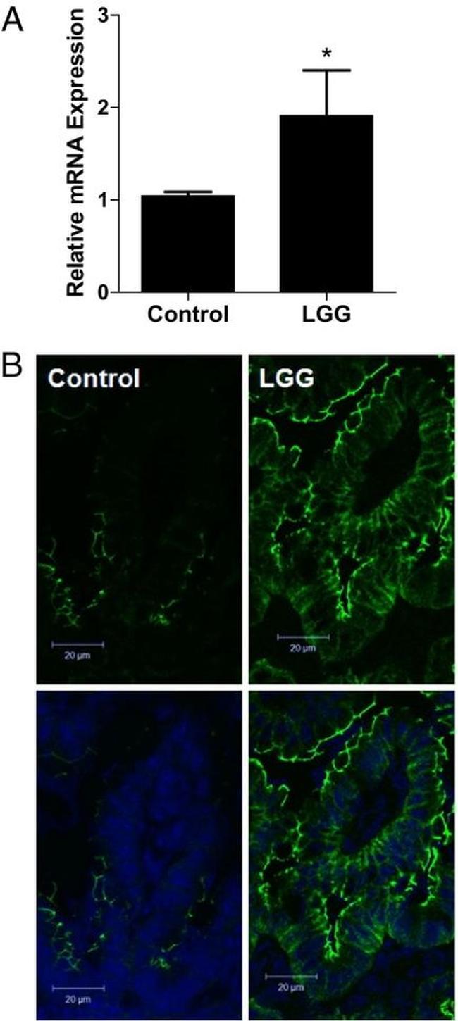 Claudin 3 Antibody in Immunohistochemistry (IHC)