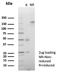 ZNF774 Antibody in SDS-PAGE (SDS-PAGE)