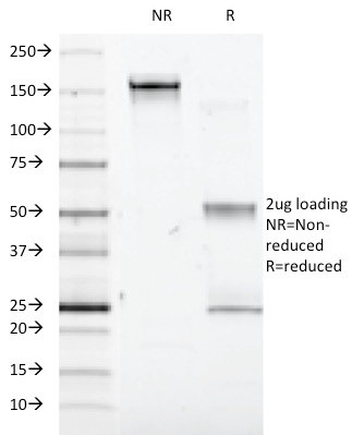 Interferon alpha-1 (IFNA1) Antibody in SDS-PAGE (SDS-PAGE)