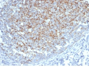 Interferon alpha Antibody in Immunohistochemistry (Paraffin) (IHC (P))