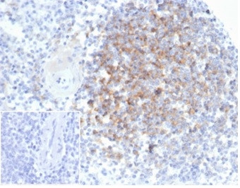 Interferon alpha Antibody in Immunohistochemistry (Paraffin) (IHC (P))