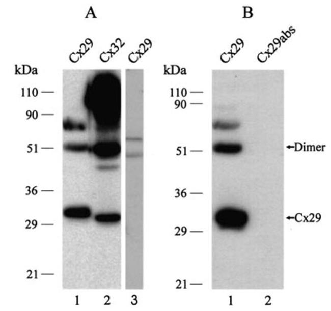 Connexin 29 Antibody in Western Blot (WB)