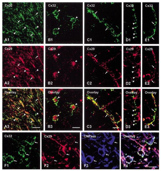 Connexin 32 Antibody in Immunohistochemistry (Frozen) (IHC (F))