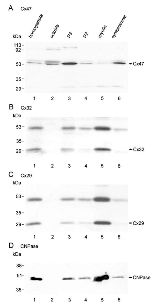 Connexin 32 Antibody in Western Blot (WB)