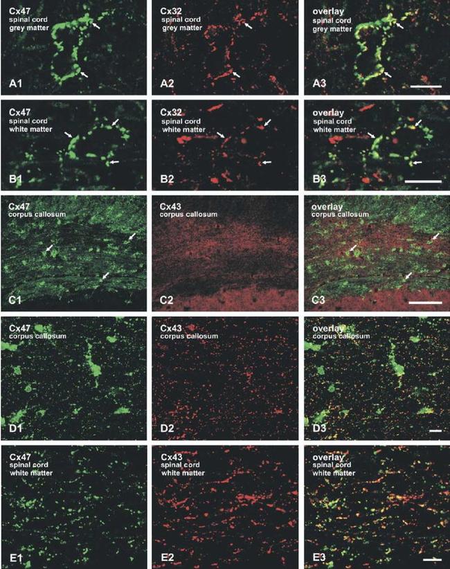 Connexin 32 Antibody in Immunohistochemistry (IHC)