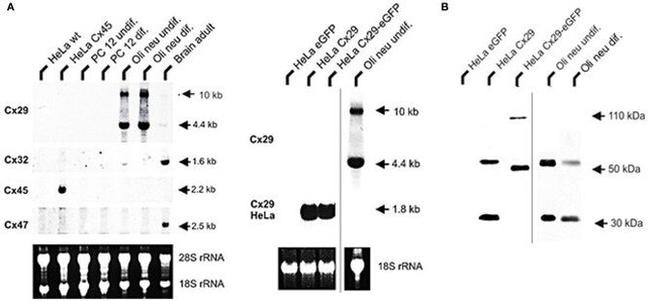 Connexin 29 Antibody in Western Blot (WB)