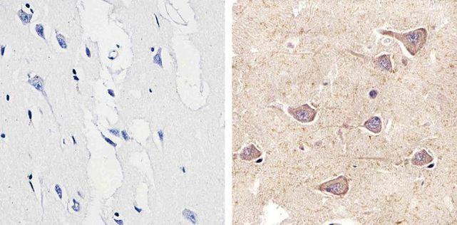 Connexin 29 Antibody in Immunohistochemistry (Paraffin) (IHC (P))