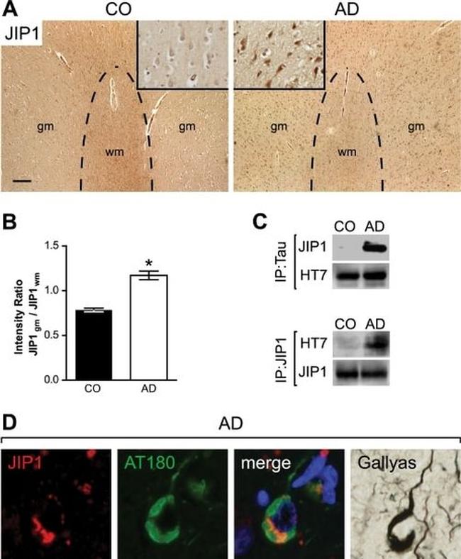 JIP1 Antibody in Immunocytochemistry (ICC/IF)