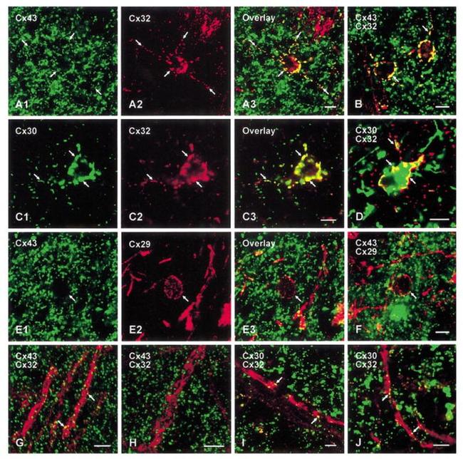 Connexin 32 Antibody in Immunohistochemistry (Frozen) (IHC (F))