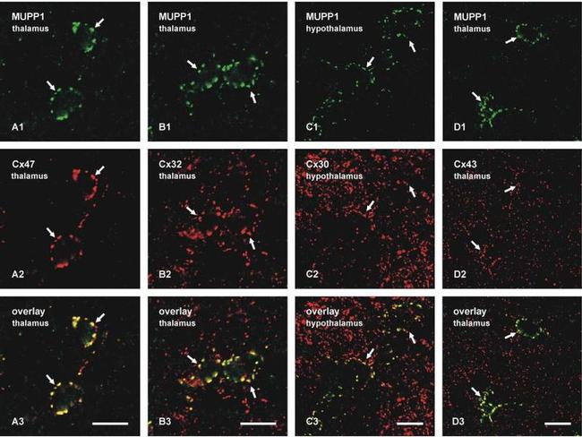 Connexin 32 Antibody in Immunohistochemistry (IHC)