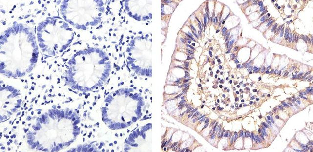 CD146 Antibody in Immunohistochemistry (Paraffin) (IHC (P))