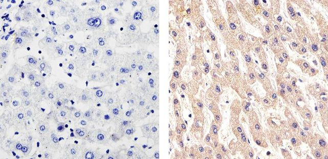 CD146 Antibody in Immunohistochemistry (Paraffin) (IHC (P))