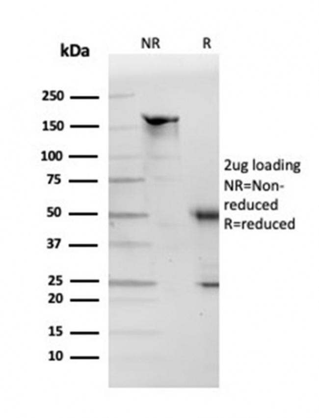 Apolipoprotein D/APOD Antibody in SDS-PAGE (SDS-PAGE)