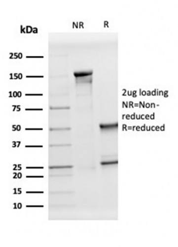 Apolipoprotein D/APO-D Antibody in SDS-PAGE (SDS-PAGE)