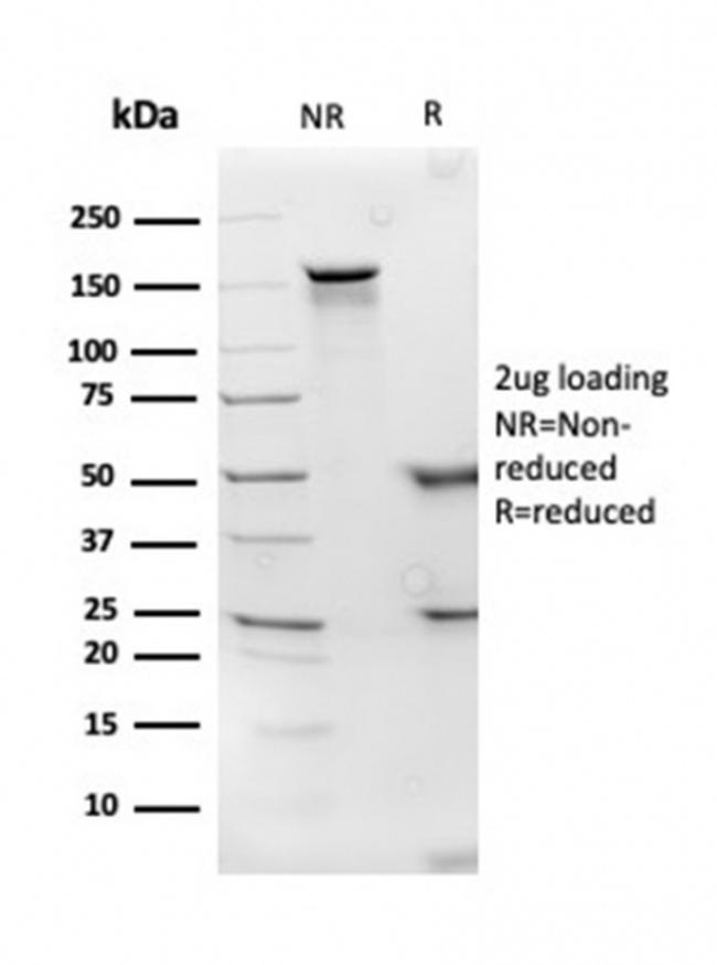 Apolipoprotein D/APOD Antibody in SDS-PAGE (SDS-PAGE)