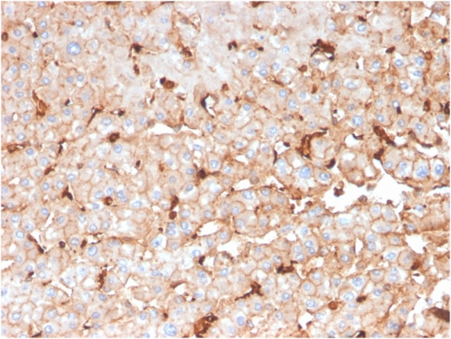 Apolipoprotein D/APOD Antibody in Immunohistochemistry (Paraffin) (IHC (P))