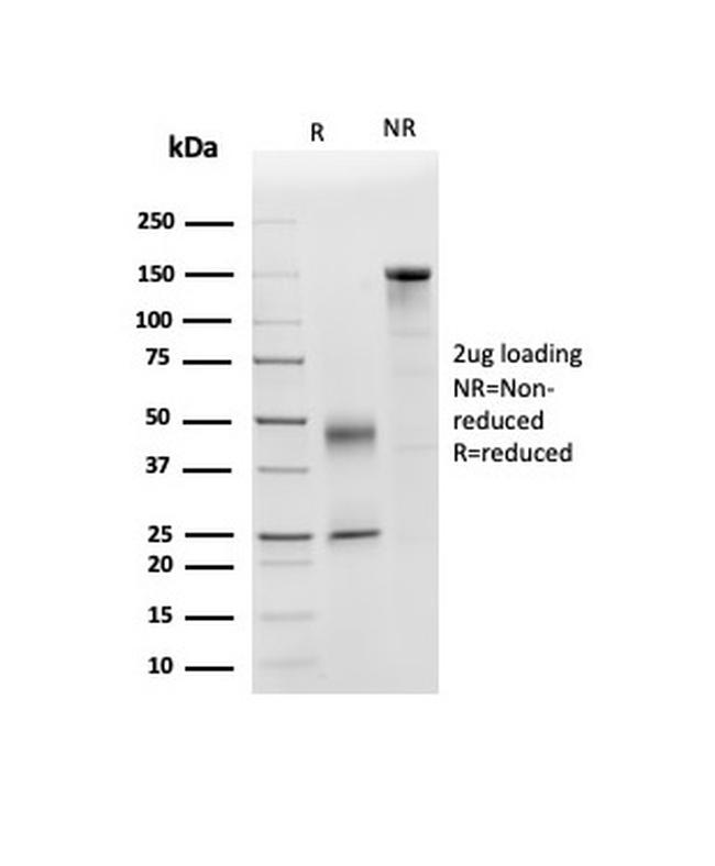 Apolipoprotein D/APO-D Antibody in Immunoelectrophoresis (IE)