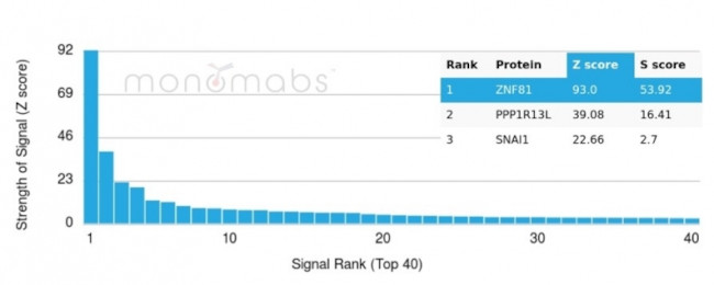 ZNF81/Zinc finger protein 81 (Transcription Factor) Antibody in Peptide array (ARRAY)