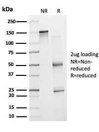 ZNF81/Zinc finger protein 81 (Transcription Factor) Antibody in SDS-PAGE (SDS-PAGE)