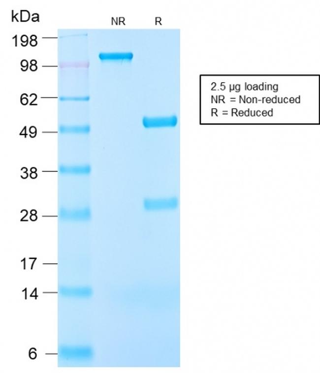 Insulin-like Growth Factor-1 (IGF-1) Antibody in SDS-PAGE (SDS-PAGE)